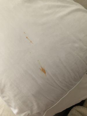 Blood on pillow