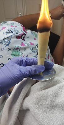 Ear candling