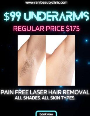 Pain free underarm laser hair removal safe for people of color using Candela Gentlemax Pro Plus and air technology!