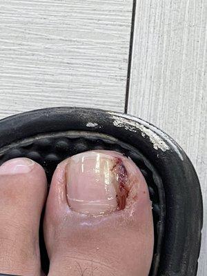 Toe