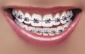 Schedule an Orthodontic Consultation, at No Charge!