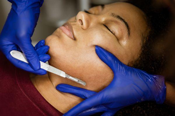 Dermaplane Skin Treatment Available as a single service or a series