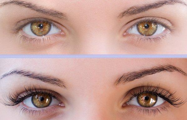 Eyes Before and After