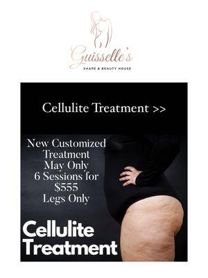 Cellulite Treatment