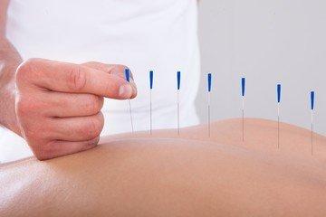 Oriental Day Acupuncture