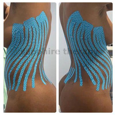 Kinesio Tape for Lymphatic Drainage