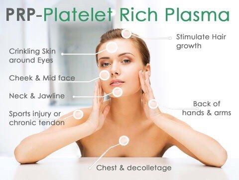 PRP, platelet rich plasma, is used for facial rejuvenation and hair restoration Renaissance Beauty.