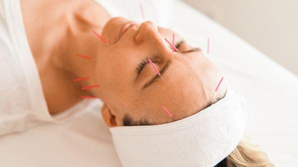 Our tailored cosmetic acupuncture treatments help brighten skin, reduce fine lines and promote graceful aging without injections