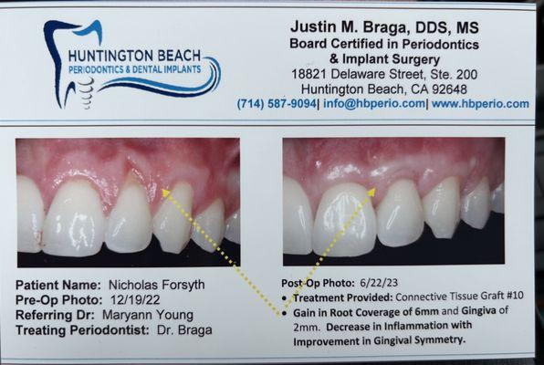 Huntington Beach Periodontics & Dental Implants