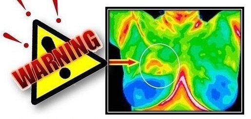 We offer Breast Thermography DITI image can detect cancer cells 8 years before mammography