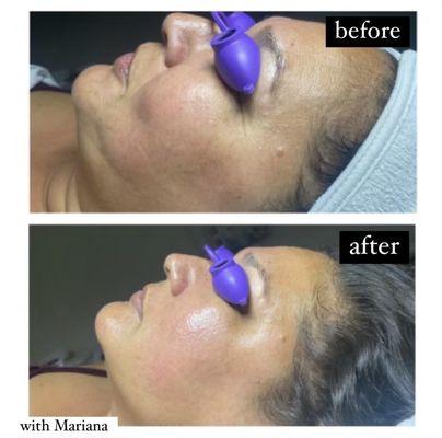 Clinical facial with Mariana!