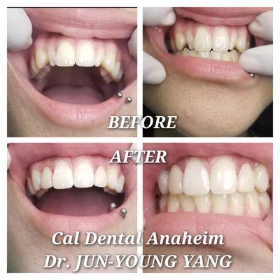 Cal Dental Anheim
3006 W LINCONLN AVE
ANAHEIM, CA 92801
(714) 828 0508