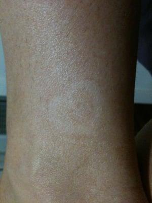 Used a heart sticker to show the color change from their darkest spray tan (level 3). Not much color :0(