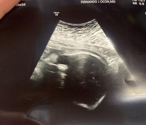 this is supposedly my baby's "face" does anyone see a face here!?.