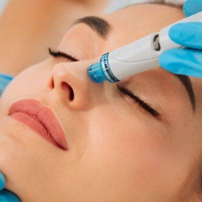 Microdermabrasion