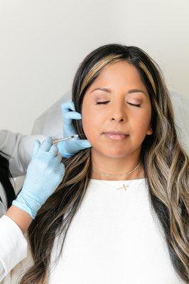 Dermal filler can be applied to the jawline for a more streamlined silhouette.