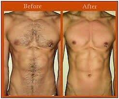 Men's Chest Waxing-Hair Removal