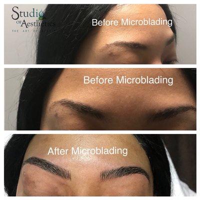 Microblading