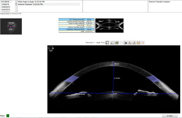 Anterior segment imaging via optical coherence tomography