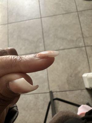 Side of my nail