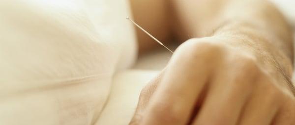 Acupuncture needles are very thin.