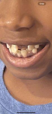 Before ortho treatment