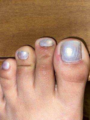 Damaged cuticles