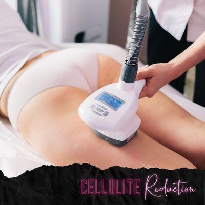 Cellulite Reduction * Eliminar Celulitis