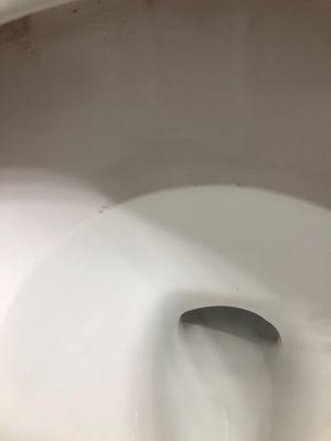 Toilet ring that was to be deep cleaned.