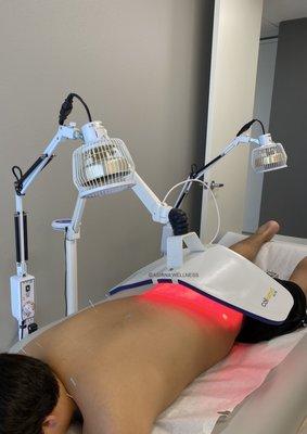 Low Back Pain Acupuncture and Near-infrared LED Light Therapy