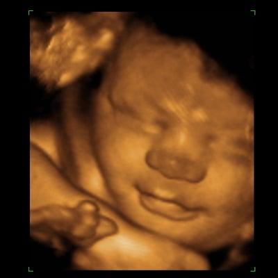 Our sweet son at 33 weeks