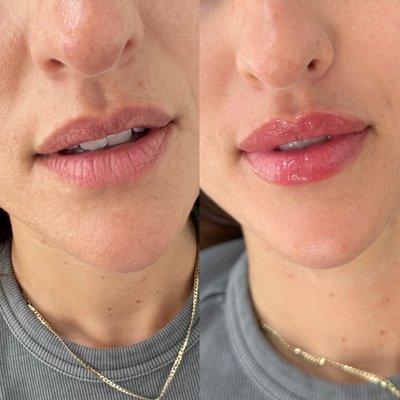 Lip hydration, beautiful natural results.