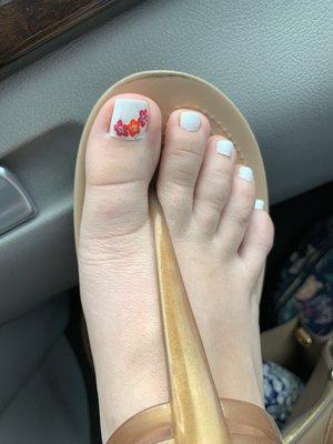 Normal and healthy toe nails!