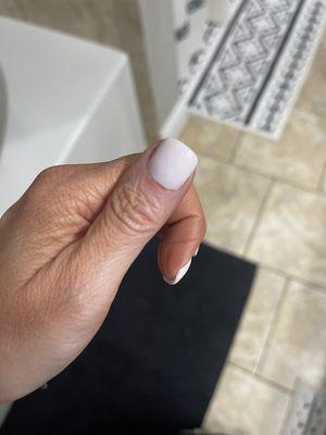 Another spot on my cuticle that's bleeding and sore after my manicure.