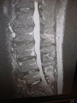 I had my first MRI here.  This is my lower spine - pretty cool!