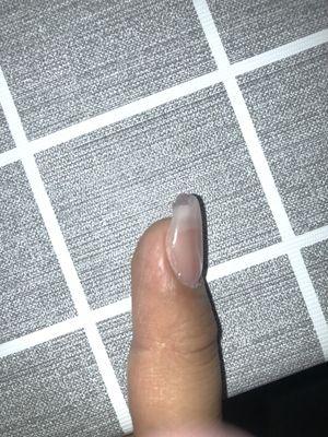 Crooked nail shape