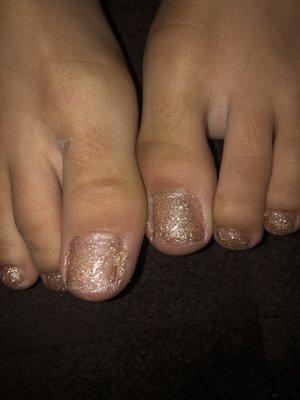 Very crappy pedicure