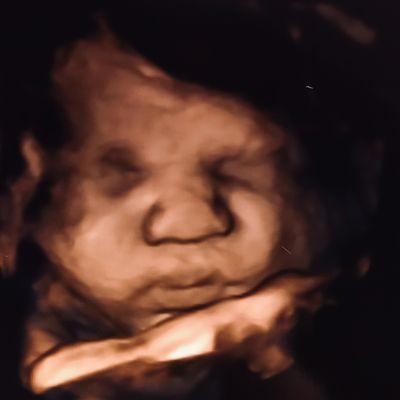 My beautiful son at 38 weeks best sonogram I have ever gotten specially at this stage in pregnancy.