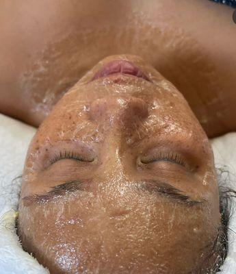 Firming Peptide Treatment