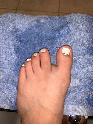 toe nails