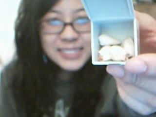 My wisdom teeth that they put in a box.