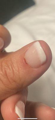 3 nail cuticles like this