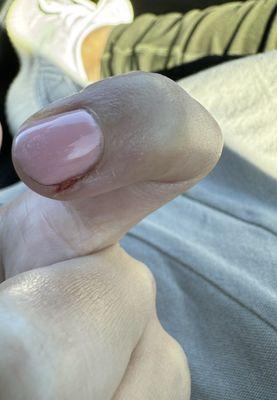 Finger sliced by a nail tech with a cuticle pusher