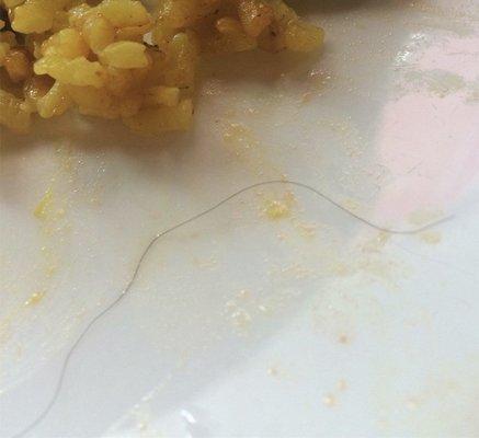 Hair in my food