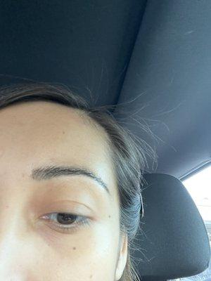 Uneven eyebrow