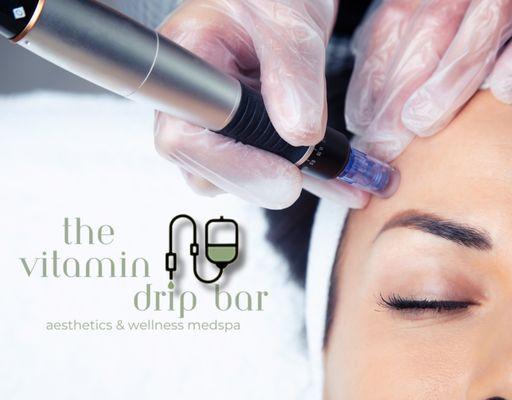 Microneedling and PRP Facial