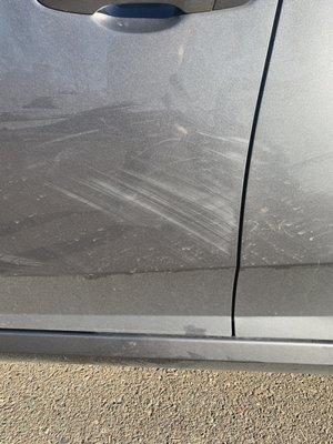 The scratches and the minor dent.