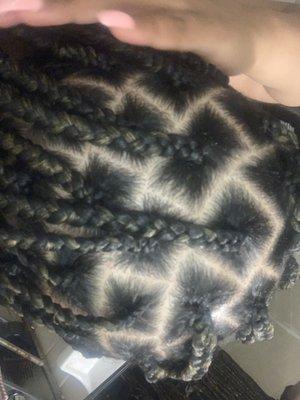 Back of my head look at the large rectangle box braid and triangle braids smh