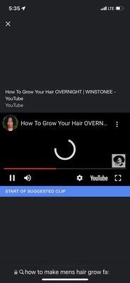 how to grow your hair back after you go to this barber