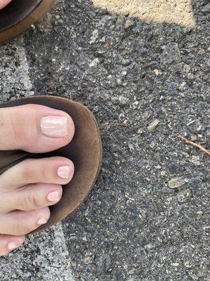 Flooded cuticle. Messy edges